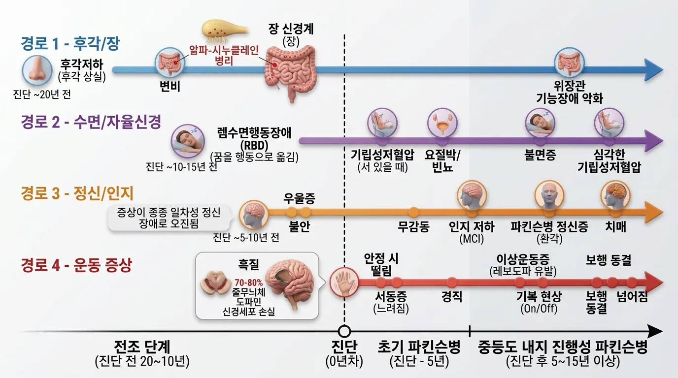 4-트랙 타임라인 — 파킨슨병 증상의 4가지 경로